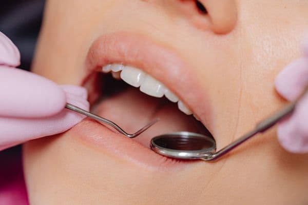 Dental Check-up & Consultation